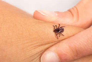 Kene Isırığı Tehlikeli mi? Bilinmesi Gerekenler